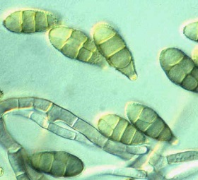 alternaria black mould spores